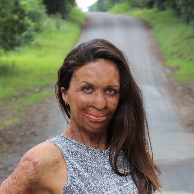 Turia Pitt